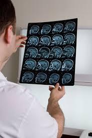 Un test de sange poate indica gravitatea unui traumatism cerebral