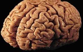 O tanara din SUA a facut un RMN si a aflat ca ii lipseste o parte importanta din creier 