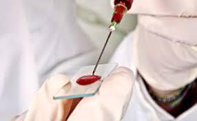 Cercetătorii americani au realizat un test de sânge capabil să depisteze infecţiile virale de care un om suferă în prezent sau a suferit în trecut 