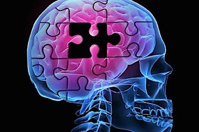 Alzheimer: Primul semn al bolii este reducerea aportului de sânge în creier