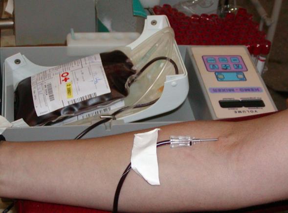 Dr. Doina Goşa: Pacienţii cu cancer sunt ameninţaţi cu întreruperea chimioterapiei din cauza lipsei de sânge! 