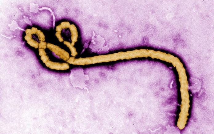 Sindromul post-Ebola: 3 din 4 supraviețuitori ai infecției au, în continuare, probleme de sănătate