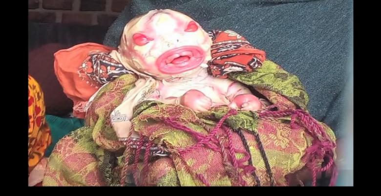 Spital luat cu asalt după naşterea unui copil-extraterestru (Video)