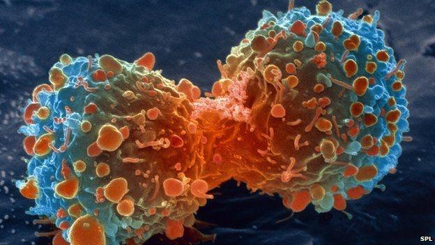 Tratament anti-cancer, care ţinteşte "călcâiul lui Ahile" al tumorii!