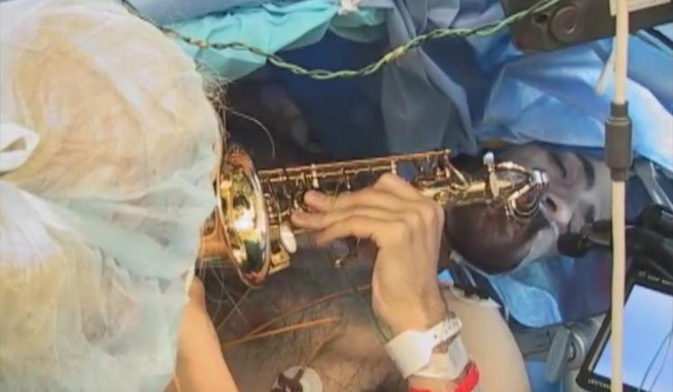  Pacientul cânta la saxofon, în timp ce medicii îl operau pe creier