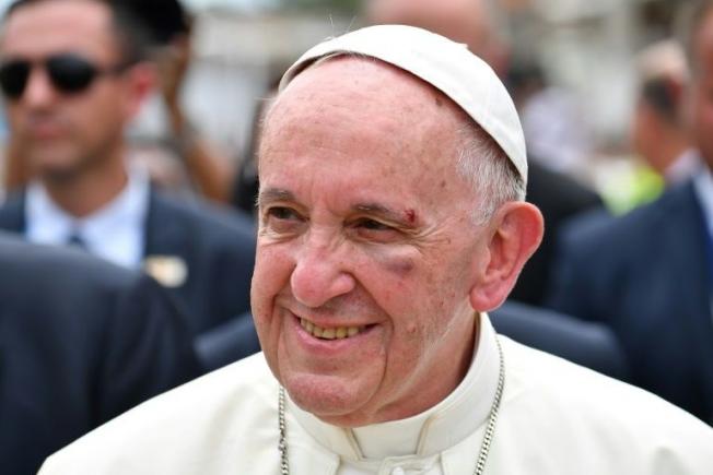 Papa Francisc: A bătut la ușa unei simple femei care i-a pansat rana de la sprânceană și a pledat pentru pace în locul culturii morții 