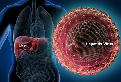 OMS: Nouă țări ar putea eradica hepatita C până în 2030!