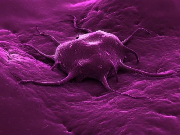 O tulpină de virus care provoacă răceala ar putea veni de hac cancerului de vezică urinară non-invaziv