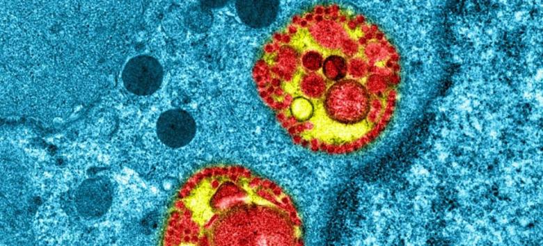 Coronavirusul actual este mai infecţios decât variantele iniţiale - studiu