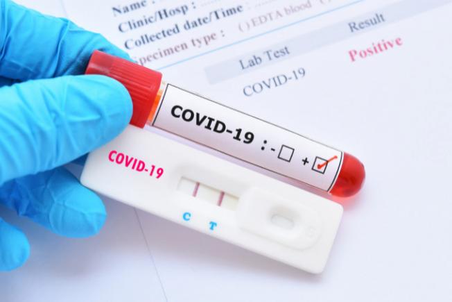 Număr-record de cazuri de infectare cu noul coronavirus în România
