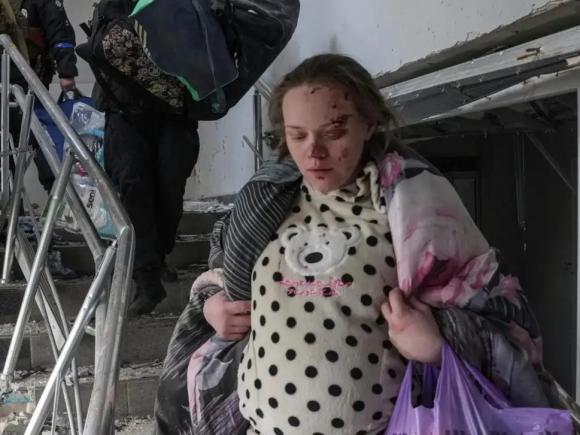 Femeia însărcinată fotografiată la maternitatea din Mariupol a apărut într-un interviu de propagandă pro-Rusia