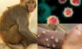 OMS: Variola maimuței continuă să se răspândească
