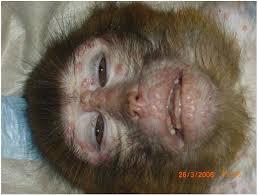 OMS schimbă denumirea variolei maimuței (eng. - monkeypox) pentru a evita stigmatizarea maimuțelor