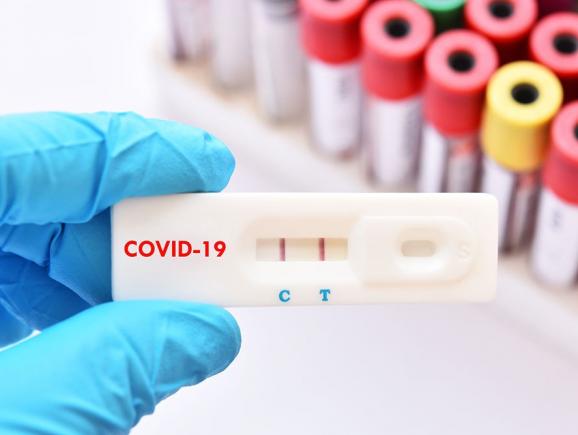 O forma severă de Covid-19 ar putea ascunde un viitor cancer încă nediagnosticat, spune un studiu
