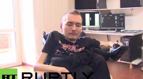 Grefa de cap pe un alt corp: Un rus s-a oferit pentru aceasta premiera chirugicala (VIDEO)