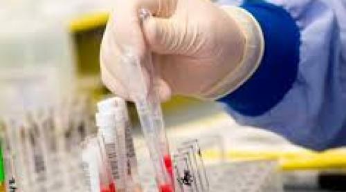 Testul de sange care poate indica riscul de cancer