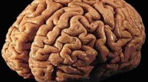 O tanara din SUA a facut un RMN si a aflat ca ii lipseste o parte importanta din creier 