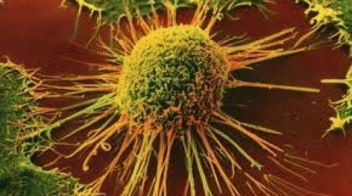 La Congresul American Society of Clinical Oncology  (Chicago, 29 mai-2 iunie), oncologii mizează pe imunoterapie în lupta cu cancerul