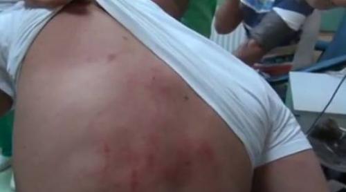  Incident. Polițiștii i-au spart capul fratelui unui deputat (VIDEO)