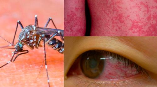 Alertă preventivă în Republica Dominicană din cauza unui virus