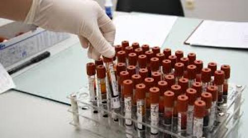 Antibiotic: Da sau Nu? Un test rapid de sânge oferă răspunsul corect