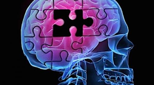 Alzheimer: Primul semn al bolii este reducerea aportului de sânge în creier