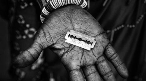 Mutilare genitala feminină în România? Ce spune legislaţia