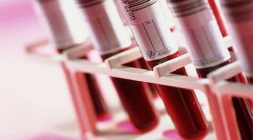 Performanţă: Sânge artificial în cantităţi mari, pentru transfuzii