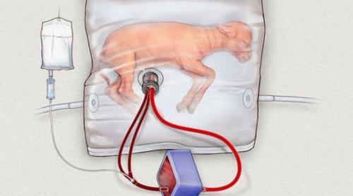 Uterul artificial pentru bebeluşii prematuri (VIDEO)