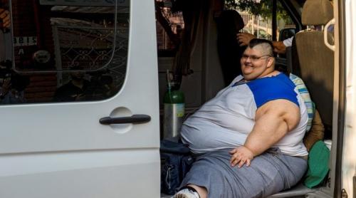 Cel mai gras om din lume va fi operat la Guadalajara