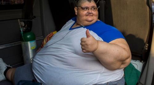 Cel mai gras om din lume a fost operat cu succes! 