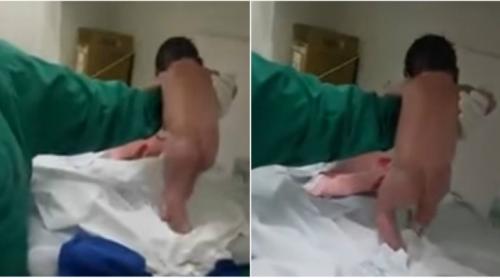 Viral: Un nou-nascut merge la citeva minute dupa nastere (VIDEO)