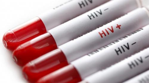 OMS: HIV începe să devină rezistent la medicamente!