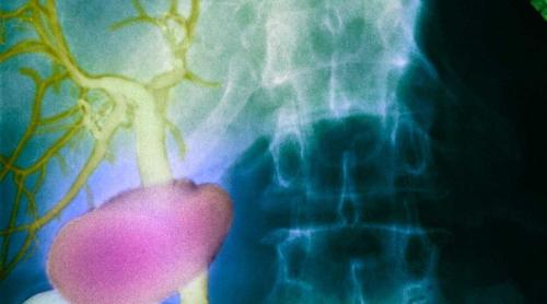 Un organ uman nou descoperit poate ajuta la descifrarea răspândirii cancerului