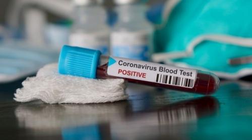 Numărul celor afectați de coronavirus a ajuns la 184 în România