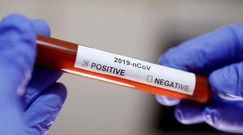 CORONAVIRUS ÎN ROMÂNIA. 31 de cazuri noi de coronavirus confirmate în ultimele 24 de ore