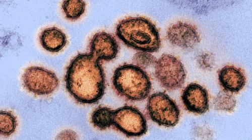 Cine ar fi crezut? Spania a depăşit Italia la numărul de infectări cu noul coronavirus