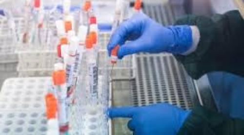 Marea Britanie a dezvoltat un test de coronavirus care transmite rezultatul în doar 75 de minute
