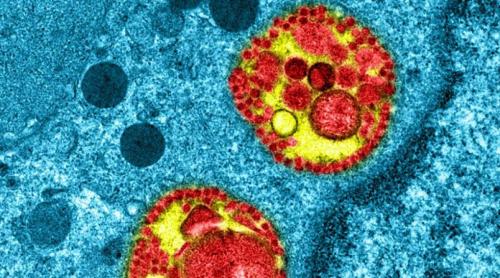 Coronavirusul circula în Franța încă din luna ianuarie, cu intensitate mică, potrivit cercetătorilor de la Institutul Pasteur