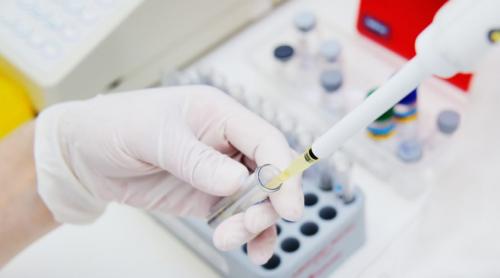 Statele Unite aprobă un nou test de coronavirus, care permite prelevarea mostrelor acasă