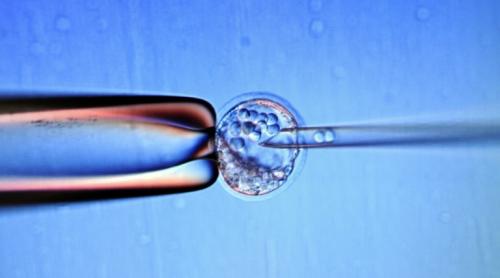 Record mondial: Japonia a realizat primul transplat de celule stem hepatice pe un pacient de doar șase zile