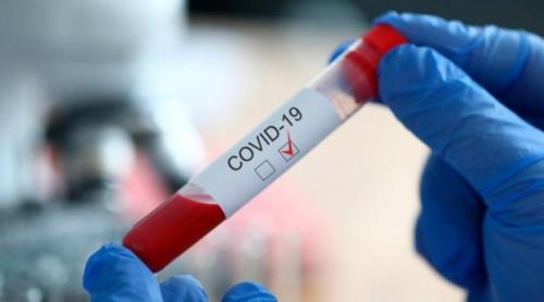 COVID-19 | 320 de noi cazuri de îmbolnăvire și 11 decese în ultimele 24 de ore