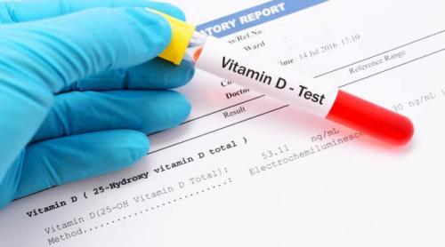 Peste 80 % dintre cei care suferă de COVID-19 au o lipsă de vitamina D