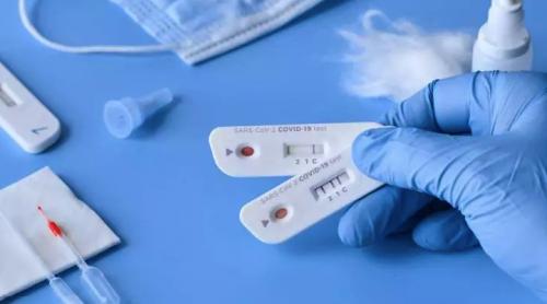 Testele rapide antigen, noua strategie pentru limitarea coronavirusului