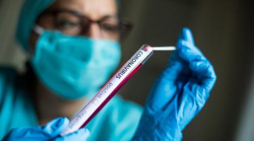 Cercetătorii ieșeni au creat un test PCR care indică tulpina virusului şi în ce stadiu se află boala