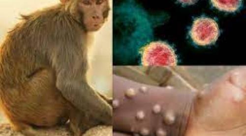 OMS: Variola maimuței continuă să se răspândească