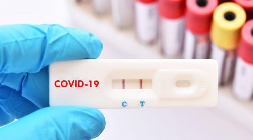 O forma severă de Covid-19 ar putea ascunde un viitor cancer încă nediagnosticat, spune un studiu
